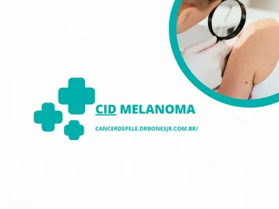 CID Melanoma