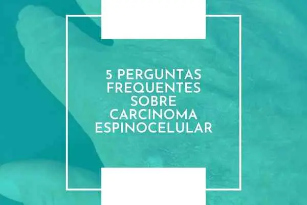 5 perguntas frequentes sobre carcinoma espinocelular