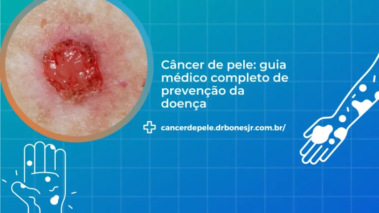 Câncer de pele guia médico completo de prevenção da doença