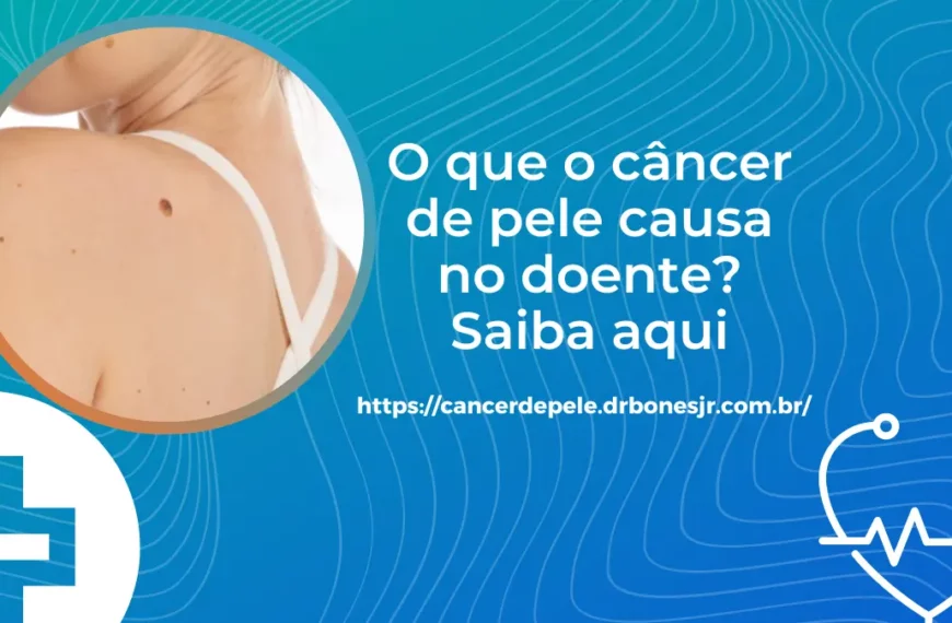 O que o câncer de pele causa no doente Saiba aqui