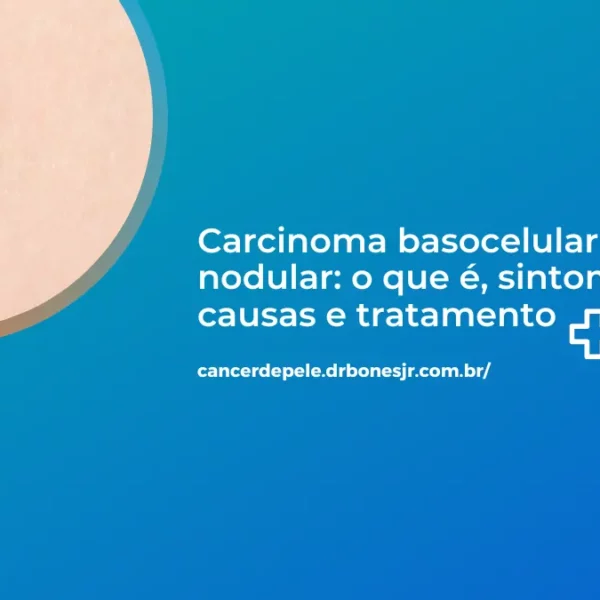 Carcinoma basocelular nodular o que é, sintomas, causas e tratamento