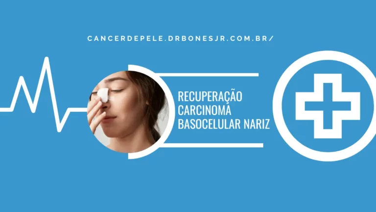 recuperação Carcinoma basocelular nariz