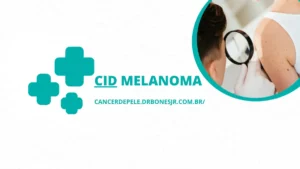 CID Melanoma