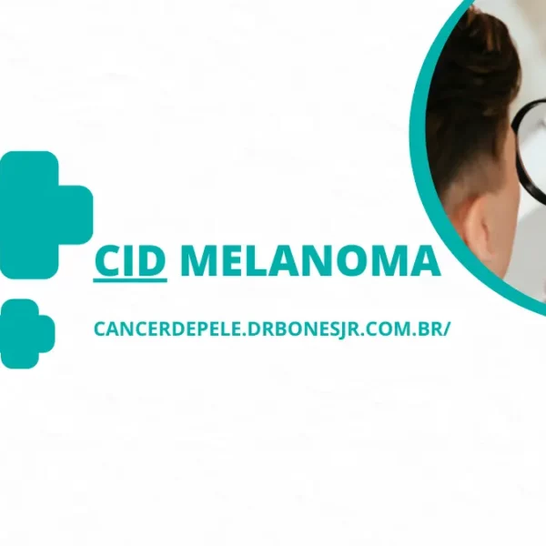 CID Melanoma