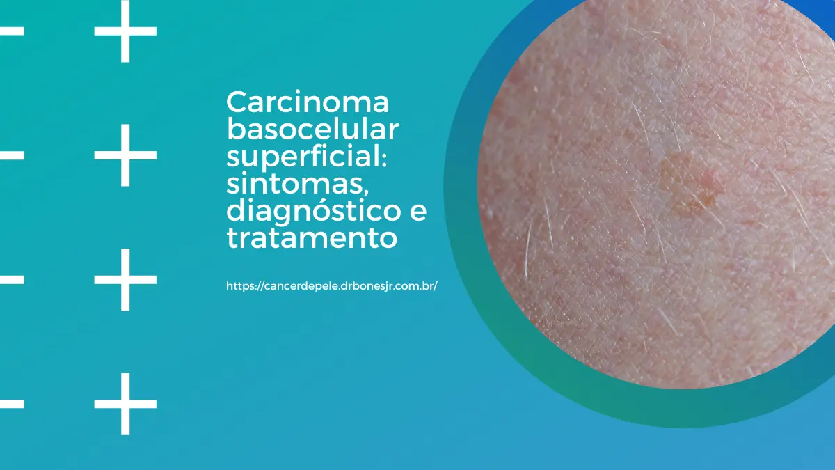 Carcinoma basocelular superficial sintomas, diagnóstico e tratamento